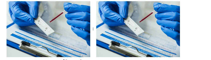 kak se pravi test za antitela